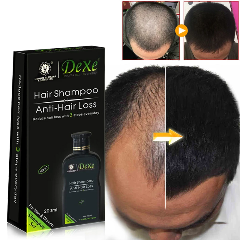 Professional hair growth Shamp - Hair Care Herbal ulasan dan harga