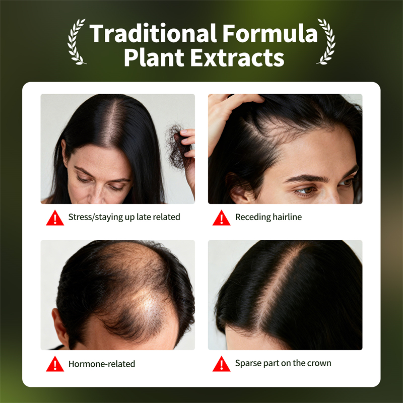 Natural Hair Growth Set Usman  - Hair Care Herbal ulasan dan harga