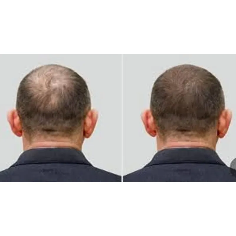 Good Seal Ozone Cap Ozone Hat  - Hair Care Good Hair ulasan dan harga
