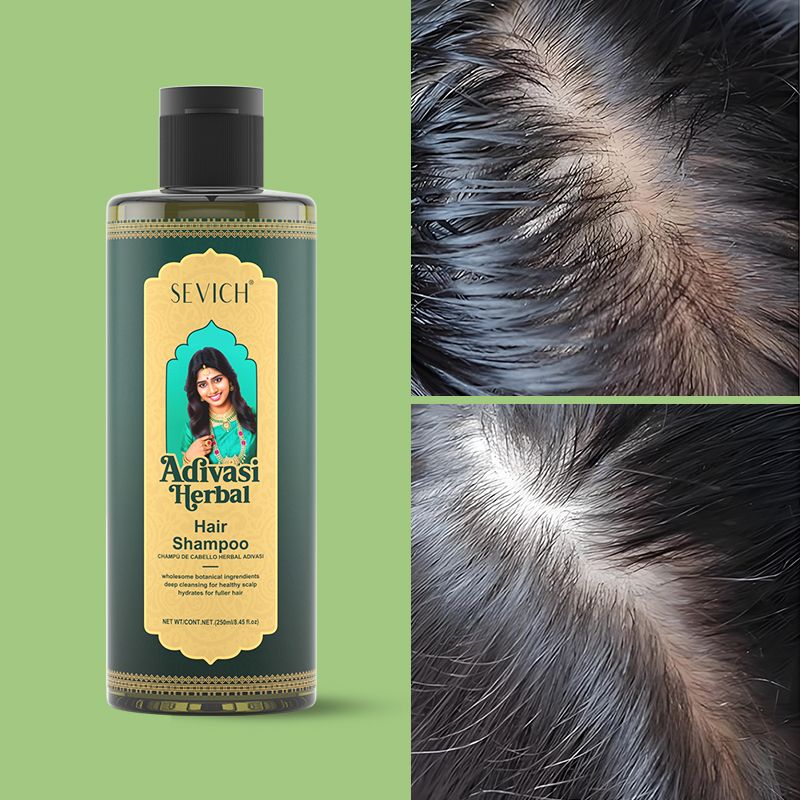Hair Growth Oil Set Rosemary H - Hair Care India ulasan dan harga