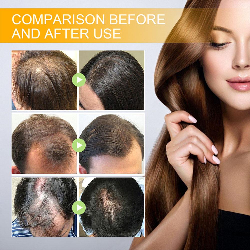 5/3/1pcs Biotin Fast Hair Grow - Hair Care Herbal ulasan dan harga